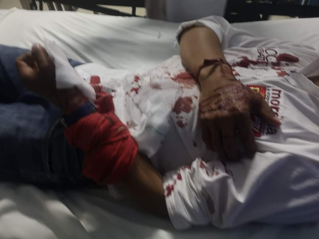 Balean a candidato de Morena a la presidencia municipal de Santa Clara Ocoyucan