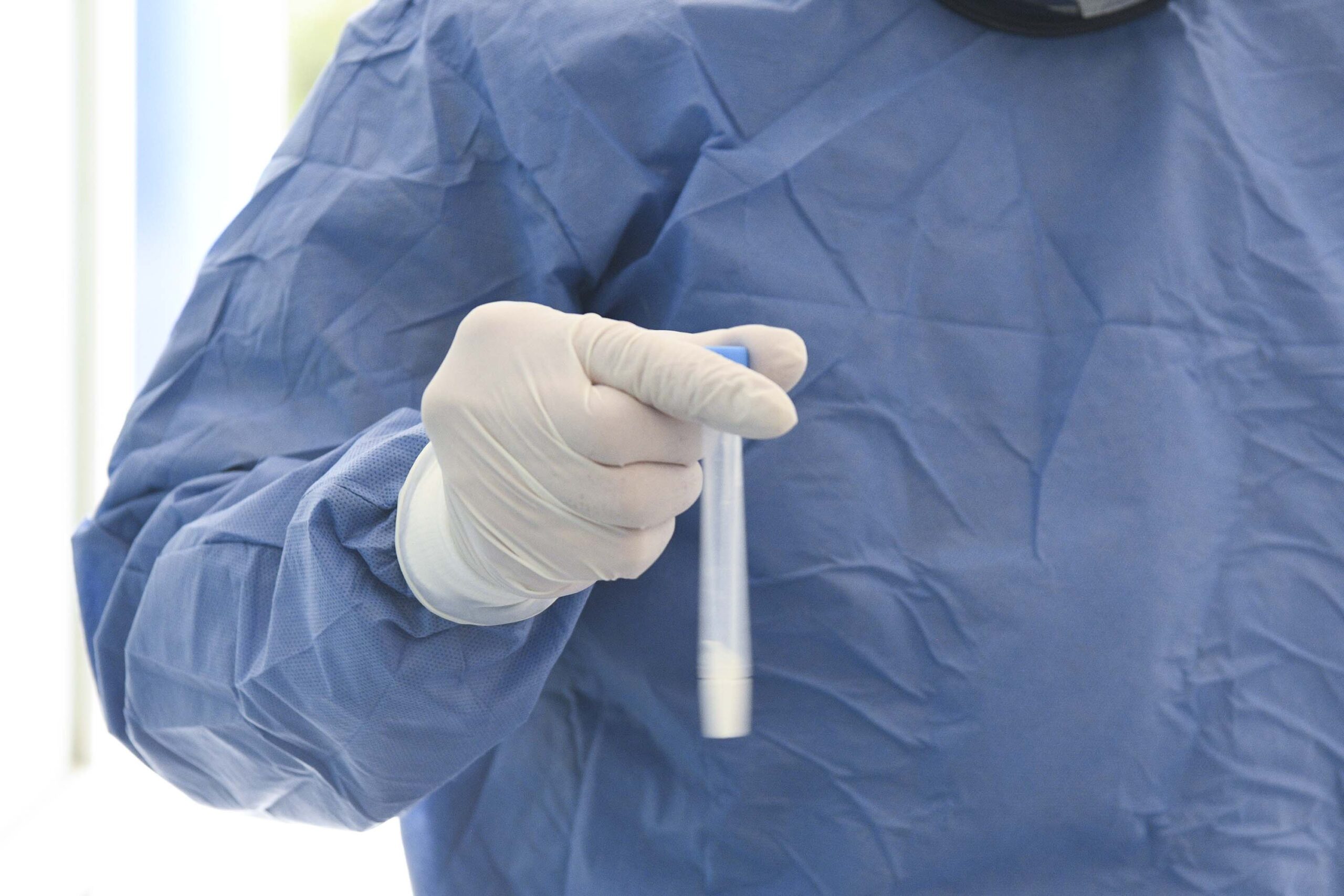 Registra Salud 18 hospitalizados por la Covid – 19