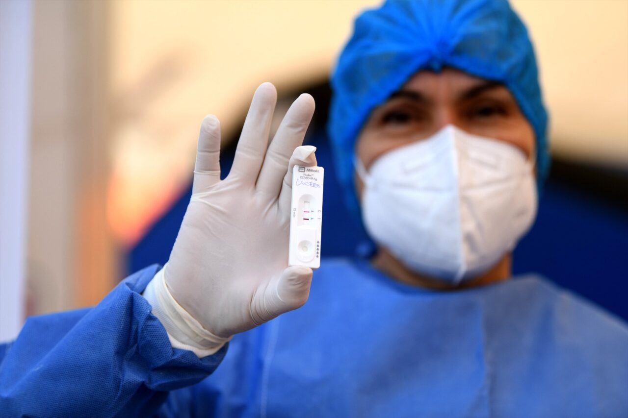 Mantiene Puebla 336 casos activos de Covid – 19: Salud