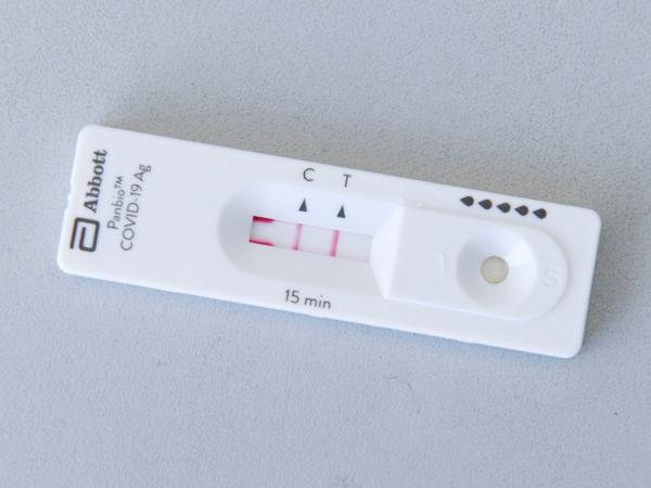 Suma Puebla 103 casos acumulados por dengue en 2024: Salud