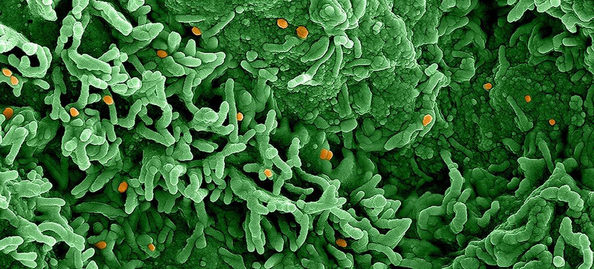 La Organización Mundial de la Salud declara la mpox una emergencia de salud pública internacional