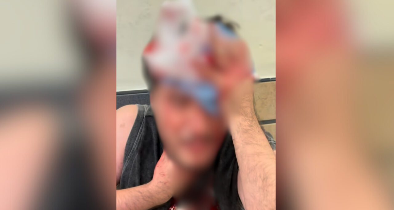 Colectivo LGBTTTIQ+ exige justicia por ataque contra Fabián Barrales en Puebla